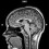 mri scan