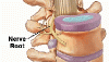 spinal nerve roots image