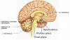 pineal-region-tumors image