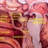 Insensitive Pituitary Adenoma 