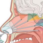 Brain Tumor:  Causes, Classification & Surgery Procedure