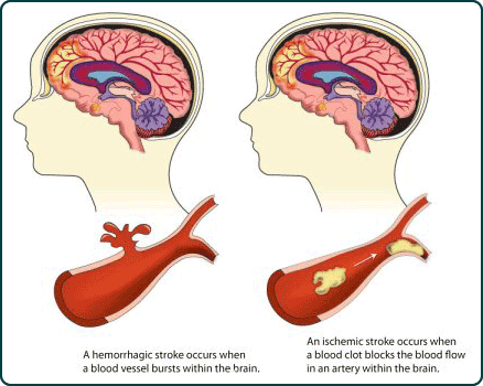 Steroids effect on the human brain